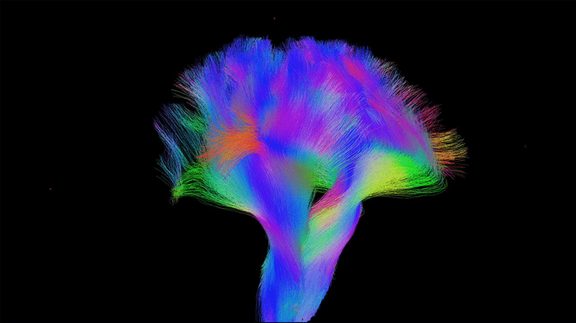 Multicolored image of the neural connections within a brain.