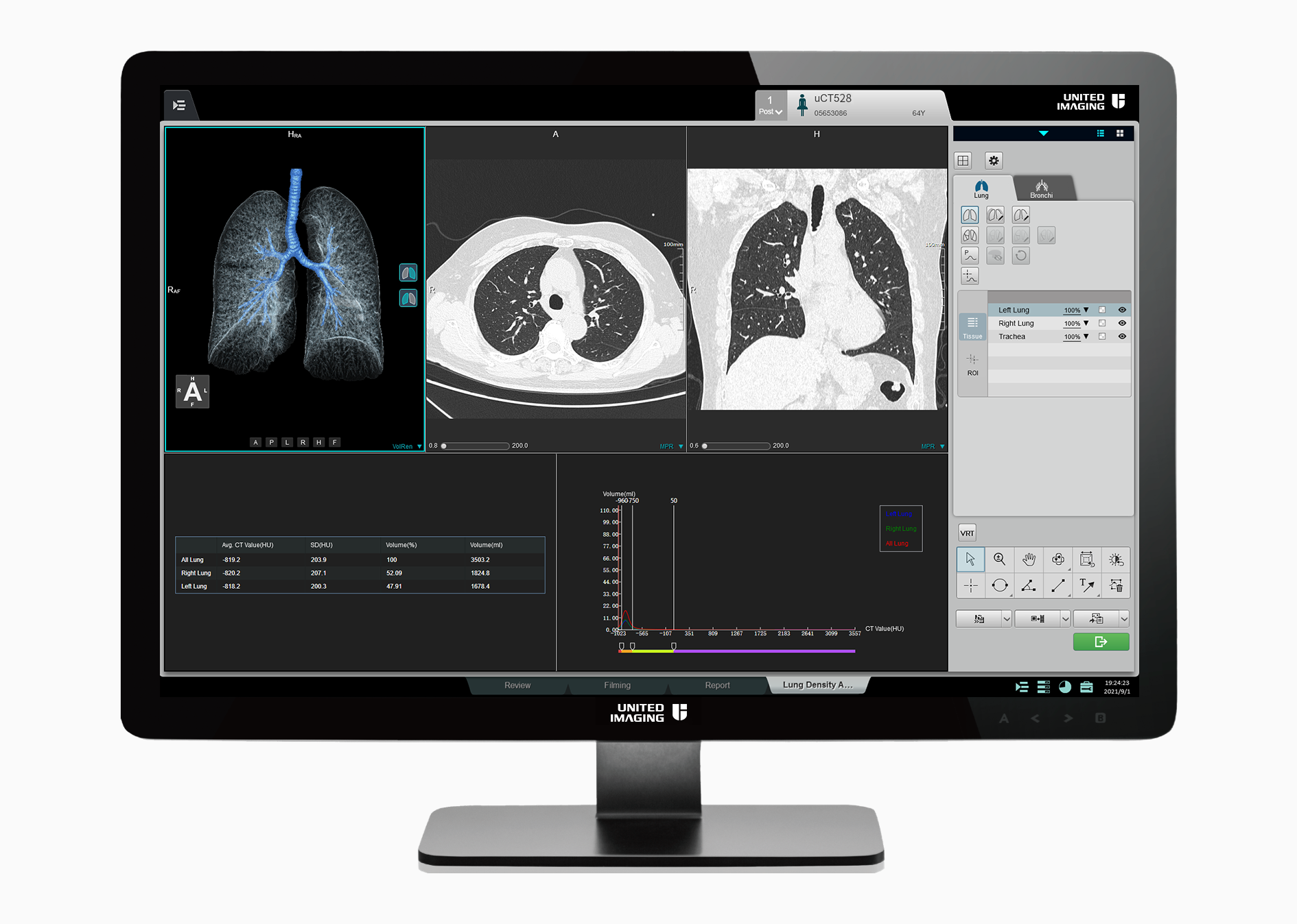 Advanced post-processing applications of uCT 528