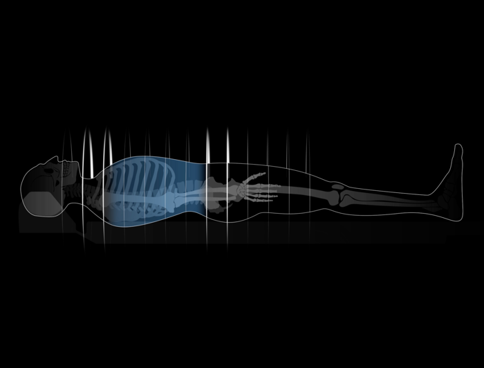 KARL 3D Iterative Denoising