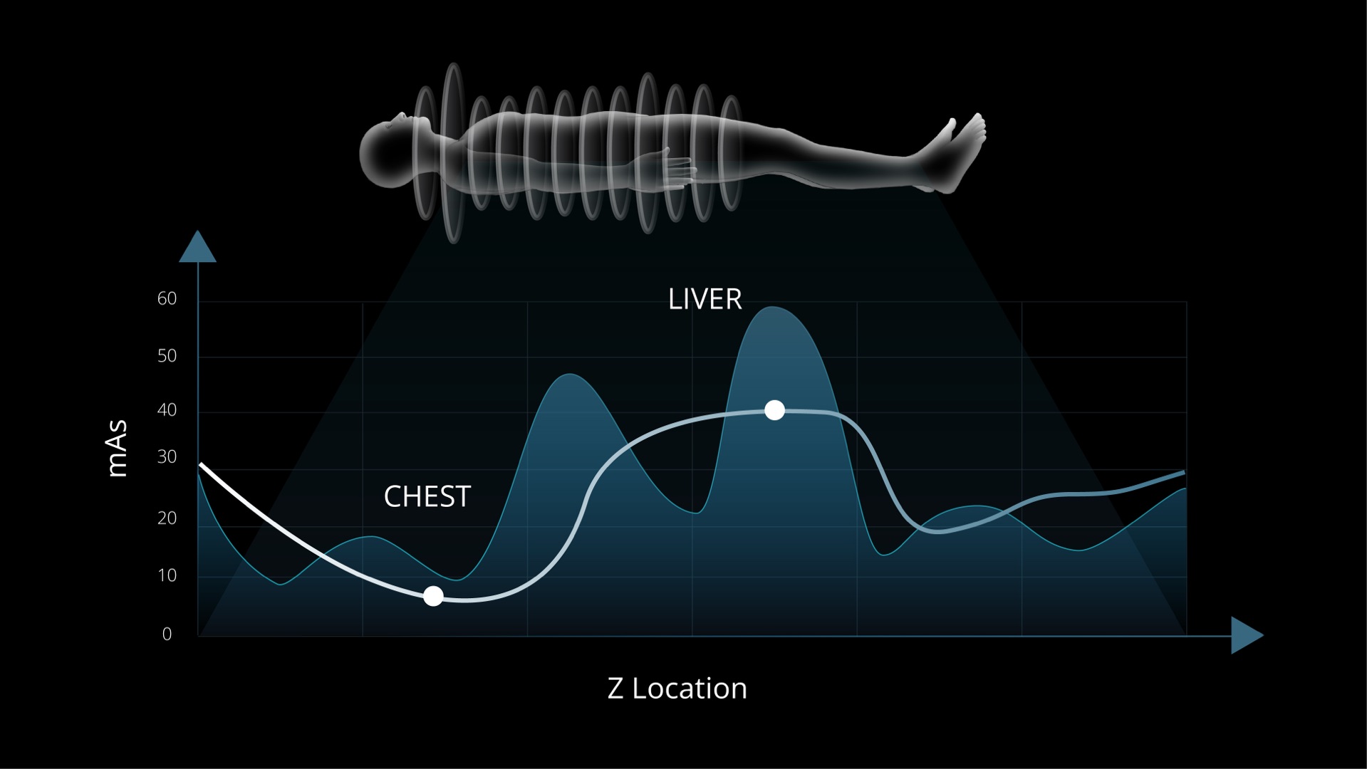 uAl Dose Modulation