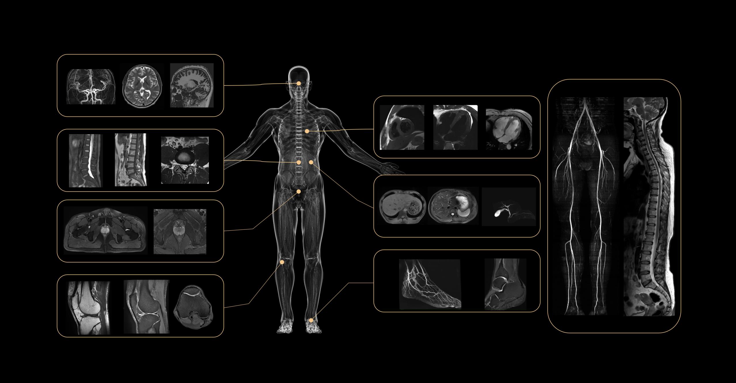 Whole-body UHF MR Imaging by uMR® Jupiter 5.0T 