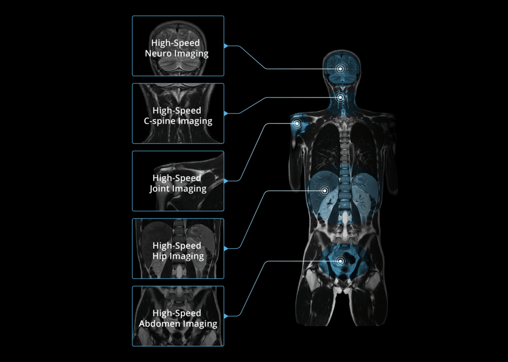 High-Speed and High Efficiency Imaging of uMR580