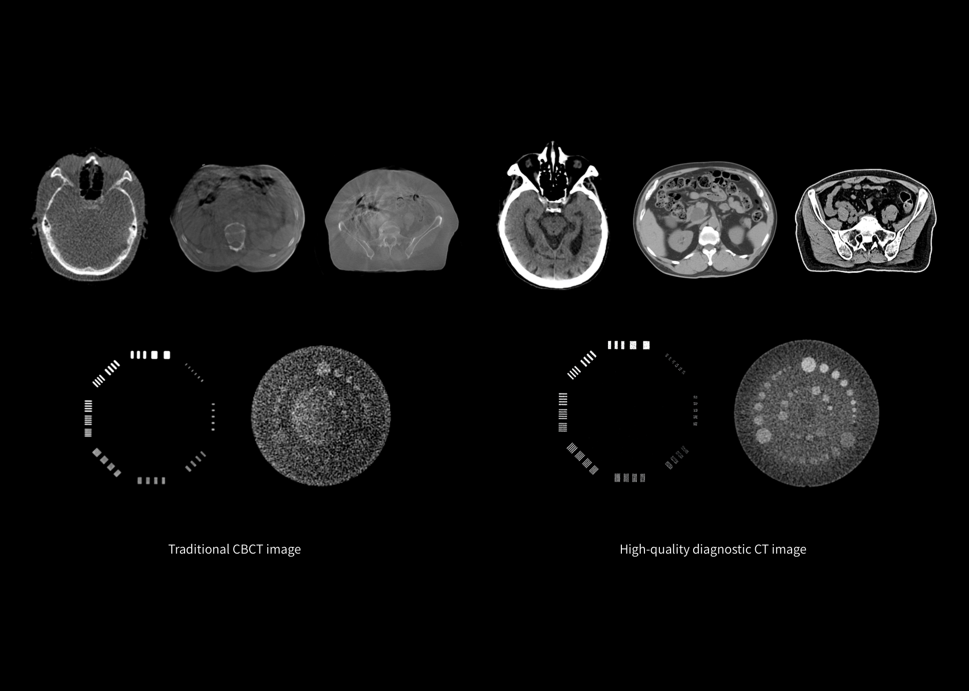 High-Quality CT-IGRT